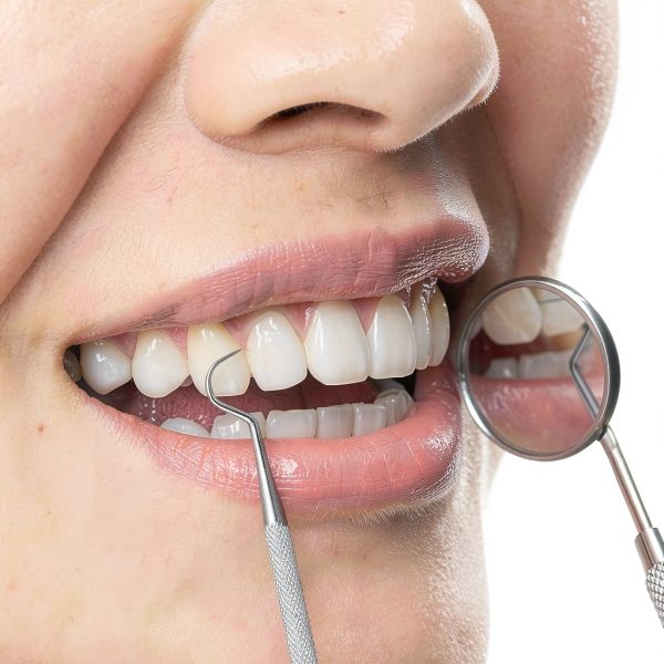 5Pcs Reusable Toothpick, Portable Metal Toothpick, Professional Teeth Cleaning Tools, Dental Picks with Toothpick Holder and Key Ring for Travel Picnic Camping-4